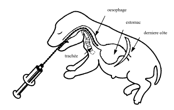 [Passage de la sonde œsophagienne]