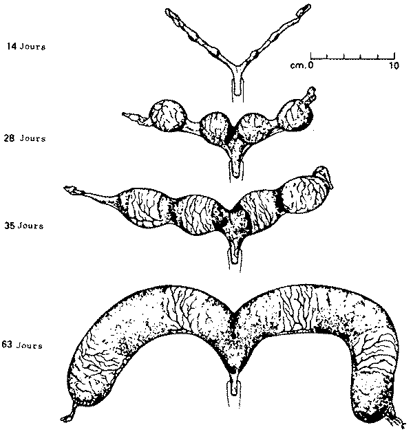 [Modifications de taille de l'utérus en cours de gestation]